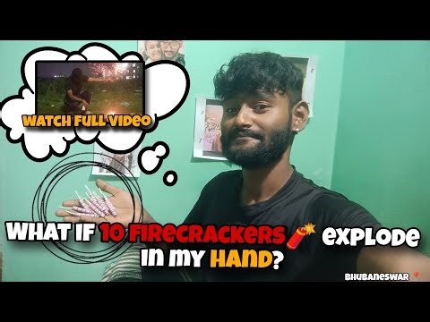 What If 10 Firecrackers 🧨 Explode In My Hand ? 💀😱 (Don't Try This At Home)