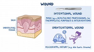 Video: Integumentary system: Wounds - Video Explanation! | Osmosis | Osmosis