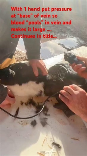 …with the catheter in the other hand, insert it I to the vein. Blood should come up the needle…