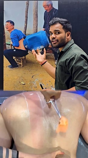 What is vacuum therapy ? |#science #education #physics #learning #experiment