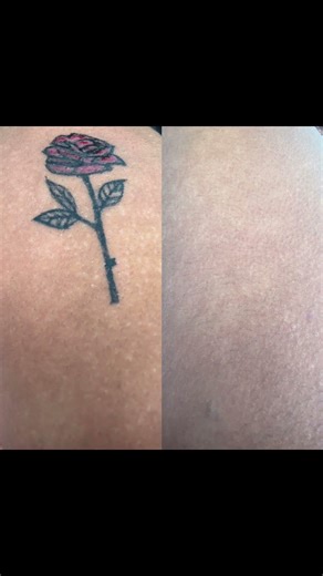 New inks #tattoo #tattooartist #tattoos #tattooideas #tattoodesign