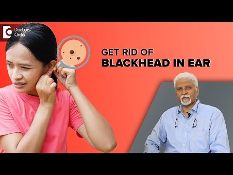 How to get rid of Blackheads in the Ear?| Ear Blackheads - Dr. Harihara Murthy | Doctors' Circle