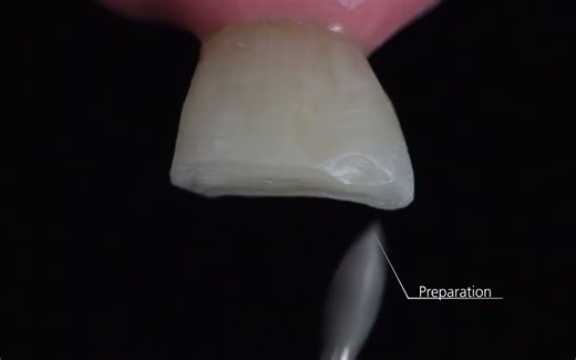 IPS Empress Direct 大师树脂官方教程！用色和器械都值得反复学习！