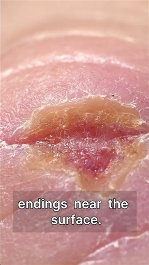 Why Do Paper Cuts Hurt So Much? | Super Simple Explanations