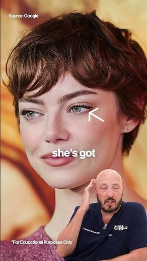 Emma Stone Before & After Plastic Surgery 🥰