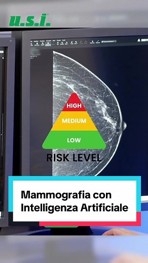 Mammografia AI: Screening Senologico più Rapido e Sicuro