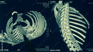 Magnetic resonance imaging (MRI) of the human chest with ribs, spine and adjacent bones. Closeup. Macro
