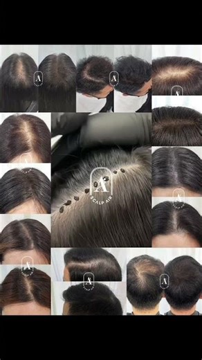 30분 시술 1회에 100만원 수입보장, 무료세미나 두피 컬러링