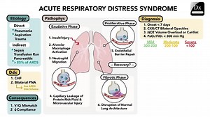 Acute Respiratory Distress Syndrome