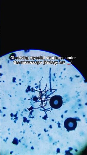 Observing mycelium under the microscope (Biology Arc 🧫)