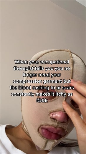 Compression garment diaries that I never posted 🙃 #compressiongarment #burns #burnsurvivor #didyouknow #learningontiktok #skin #skingraft #tiktoksg