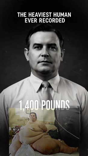 The Heaviest Man in History (1,400 Pounds