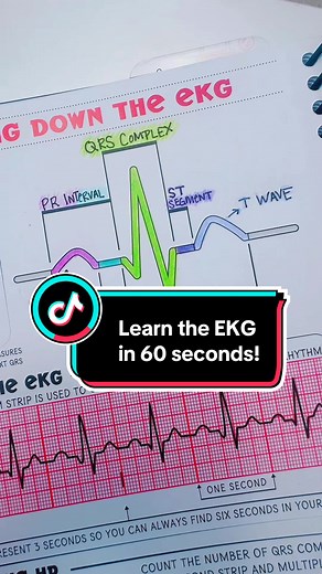 Aprende EKG en 60 segundos de manera efectiva