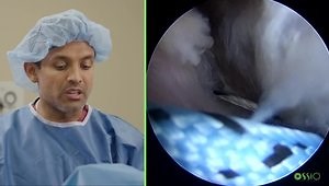 Biointegrative Rotator Cuff Repair