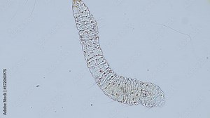 Aeolosoma (minute annelid worm) under the microscope - light microscope x200 magnification
