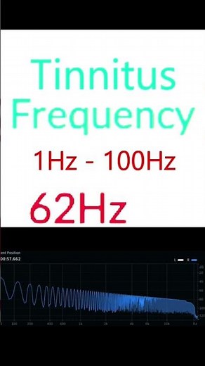 Pulsatile Tinnitus Frequencies 1Hz -100Hz