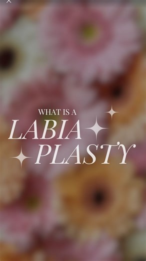 Dr. Red Alinsod, VageniusMD on Instagram: "Removal of just the edge of the labia is called Rim Look Labiaplasty. It is the most conservative aproach. Removal of almost all or all of the labia minora is called The Barbie Look (Barbie has no labia). I developed this in 2005. This is the most aggressive approach popular in California and the West Coast and the most requested look in my practice. It is certainly not for everyone. Patients who have enough labia majora to be able to cover the opening,