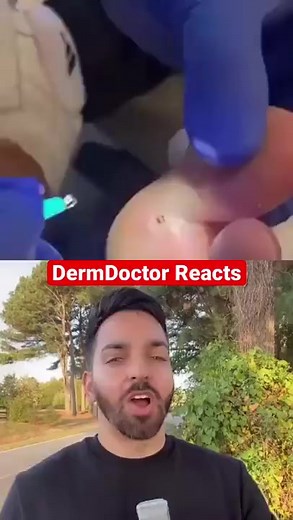 2M views · 10K reactions | Doctor Reacts to INSANE Splinter | #shorts | Doctorly | Facebook