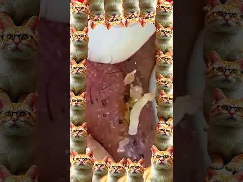 Huge blackhead removal from nose/ old aged blackheads removal/ cystic blackheads whiteheads removal