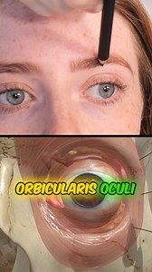 129K views · 546 reactions | Understanding anatomy is crucial because these three injection points can create vastly different results when administering toxins. If you’re eager to delve deeper into 3D anatomy, ensure you’re on the waiting list for my ProInjector membership, here's the link - https://shorturl.at/bhBFH | Dr Tim Pearce | Facebook