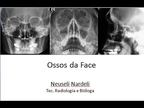 Techniques and Procedures II - Facial Bones
