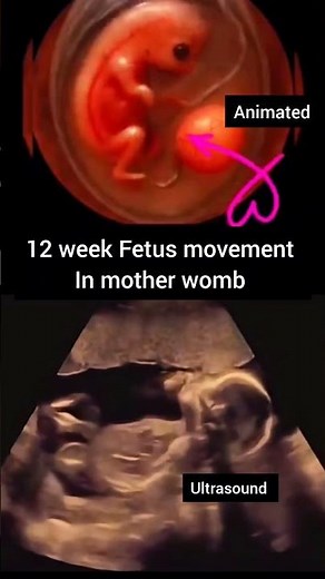 12 week Fetus movement in mother womb #baby #animated #ultrasound