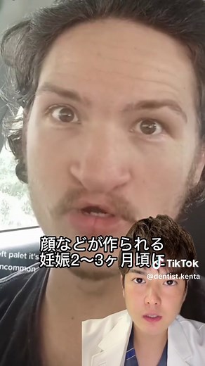 日本人に多い口唇口蓋裂の原因と症状