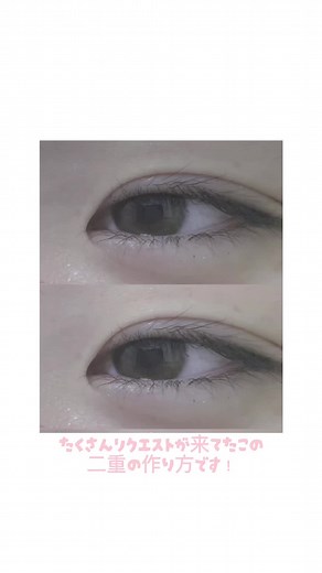 二重の作り方 | 一重が二重になる方法を徹底解説