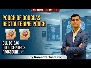 Pouch of Douglas|| Rectouterine pouch || cul-de-sac || Culdocentesis procedure
