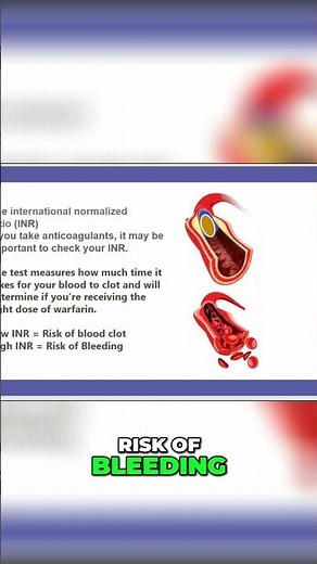2-Minute INR Levels: Understanding Blood Clot and Bleeding Risks #shorts