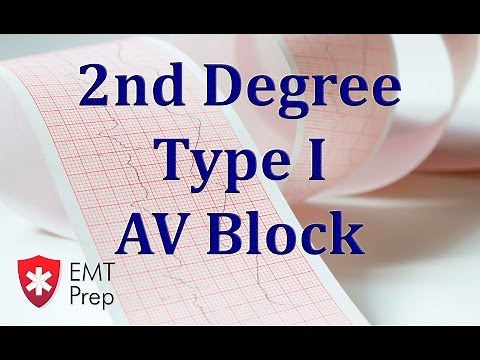 2nd Degree Type 1 AV Block ECG - EMTprep.com