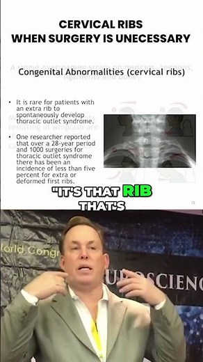 The Cervical Rib Myth: When the Extra Rib’ Isn’t the cause of Thoracic Outlet Syndrome