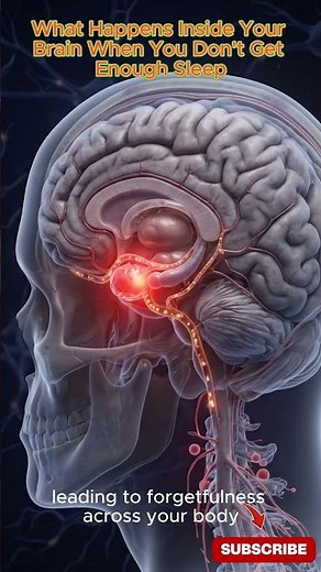 What Happens to Your Brain When You Don’t Sleep 😱 | 3D Medical Animation