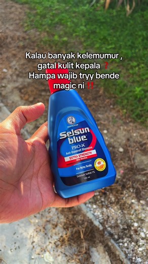 Selsun Blue for Scalp Health and Dandruff Relief