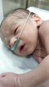 Newborn Baby Admitted to NICU for Observation | Why Monitoring Is Needed After Birth
