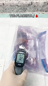 Nationwide processing in the US! Did you know a placenta could make ALL this?! 💊Placenta Capsules: What most people are here for, compressing all the benefits of placenta consumption into a easy-to-take capsules.💦Placenta Tinctures: With an amazing long-lasting shelf life that offers placenta benefits long after your capsules are gone.🧴Placenta Salves: Stretch marks, cracked nipples, perineal tearing, diaper rash cream, the healing applications are endless.I also off keepsakes Items: Tree of