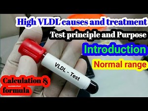 Very low Density lipoprotein (VLDL) test: Normal range: purpose: Procedure: treatments: High causes.