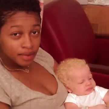 I thought my albino child was white 😳 #reels #family #albinism #child #baby | My Extraordinary Family