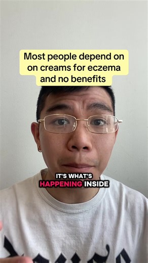 Understanding the Root Cause of Eczema