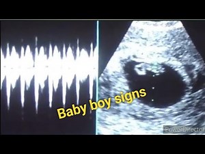 9 weeks ultrasound clearly mentioned baby boy /itne late b heart beat aati h