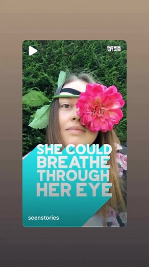 = #documentary #documental #storytime #story #eyeloss #oneeye #oneeyedgirl #confidence #motivation #insparation #scar #beautiful #devotees #education #awareness