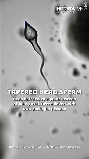 Is Your Sperm Healthy? The Science of Sperm Shape | Indira IVF
