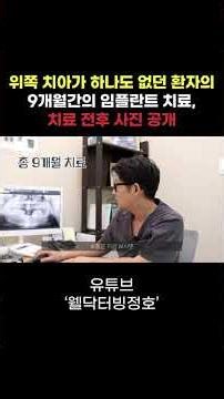 위쪽 치아가 하나도 없던 환자의 9개월 간의 임플란트 치료 과정!