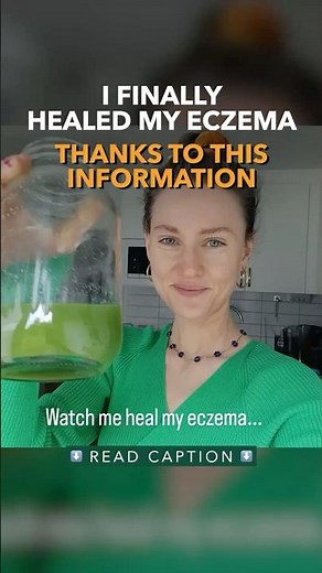 I Finally Healed My Eczema Thanks To This Information
