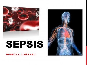 PPT - Sepsis PowerPoint Presentation, free download - ID:6920054