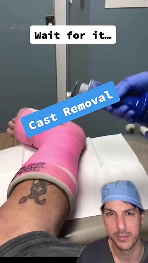 Cast Saw Removal Procedure Explained