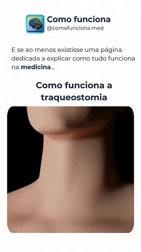 🫁✨ Como funciona a traqueostomia? É uma abertura feita na traqueia para permitir a respiração quando o ar não consegue chegar aos pulmões pelo caminho normal. Ela cria um “atalho” da pele até a traqueia e pode ser temporária ou definitiva. Entender esse processo ajuda a perder o medo e enxergar a traqueo como uma aliada na segurança da via aérea. Nos siga (@comofunciona.med) para aprender como as coisas funcionam na medicina📍 #traqueostomia #reelsbrasil #comoFunciona #viralizou | Como Funciona