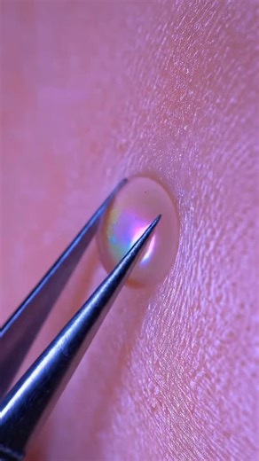 5.1K views · 29 reactions | Relaxing pimple pulls 﫧 Soft stretches, clean pops, pure ASMR calm. #ASMR #Slime #Satisfying #OddlySatisfying #AI | Vexx Labss | Facebook