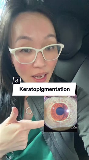 Eye Color Change Laser: Risks & Reality