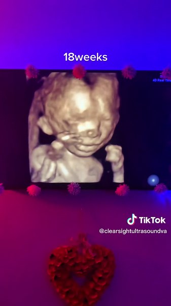 ClearSight Ultrasound on TikTok